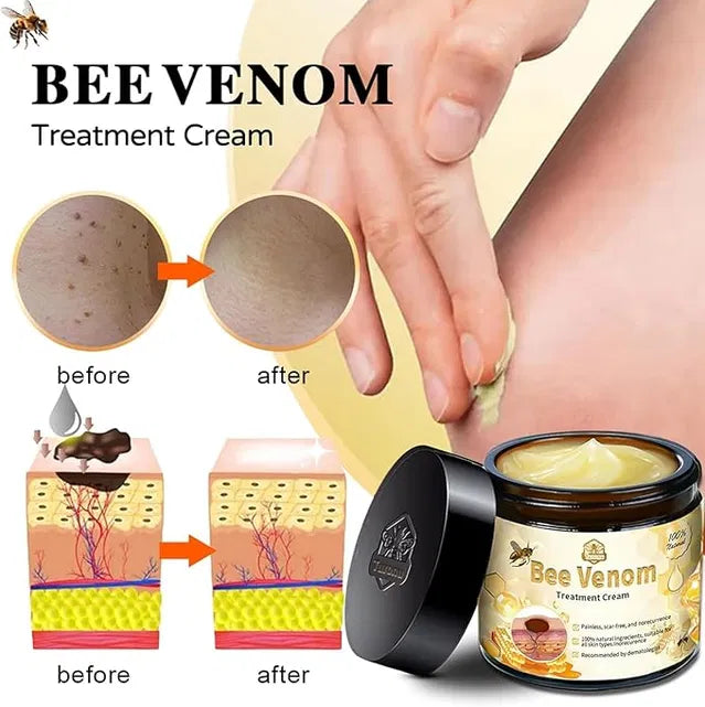 Zidella 50g