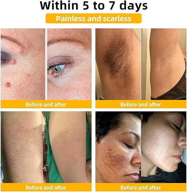 Zidella  50g