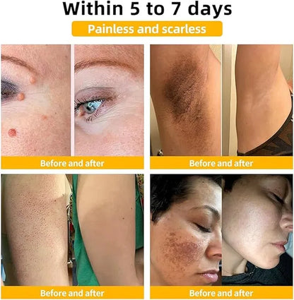 Zidella  50g