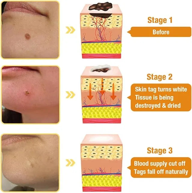 Zidella  50g