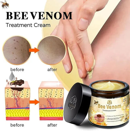 Zidella  50g